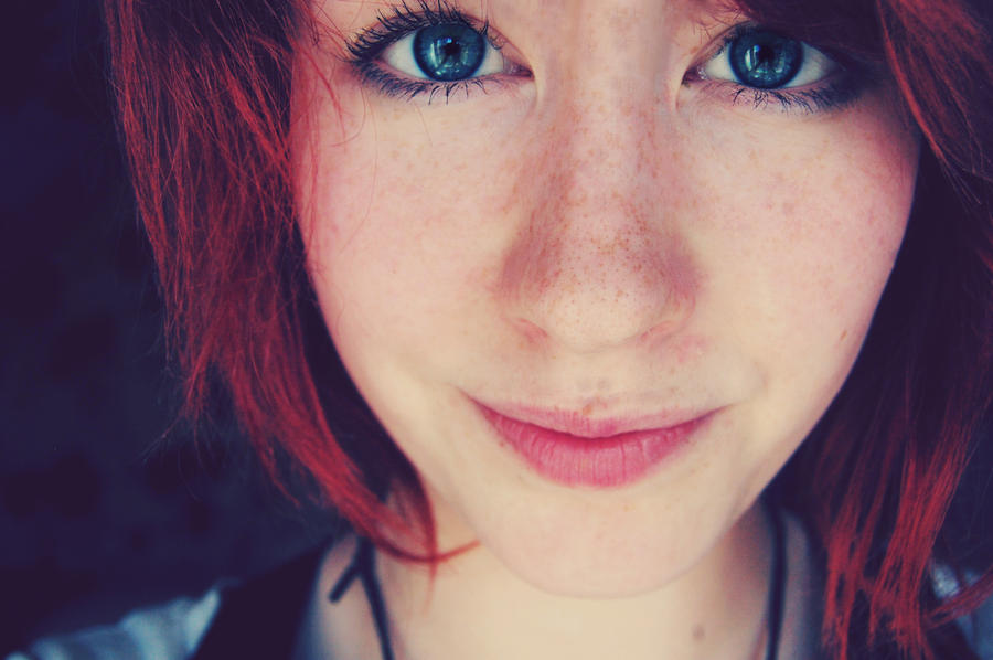 blue freckle