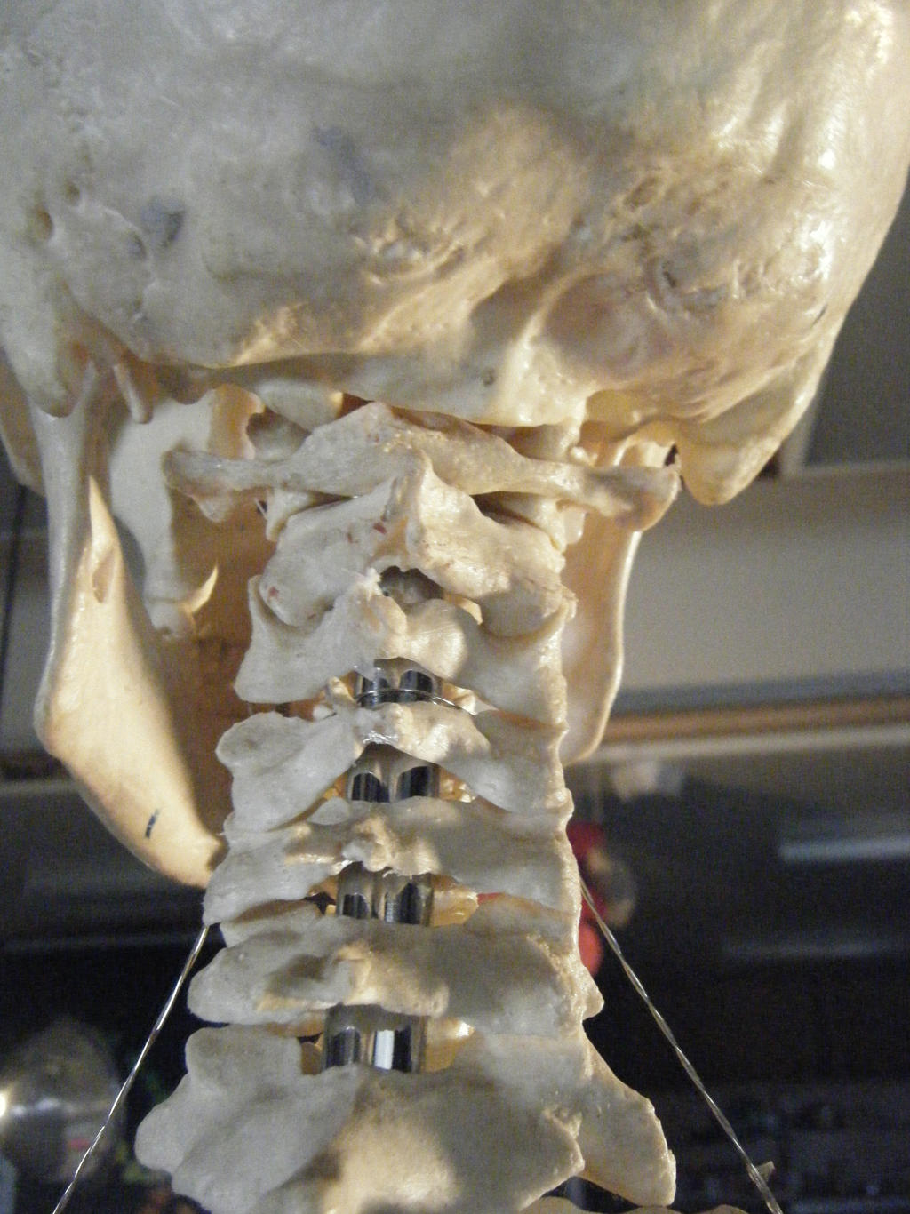 Human Skeleton Reference- The Neck by cheyenna45 on DeviantArt
