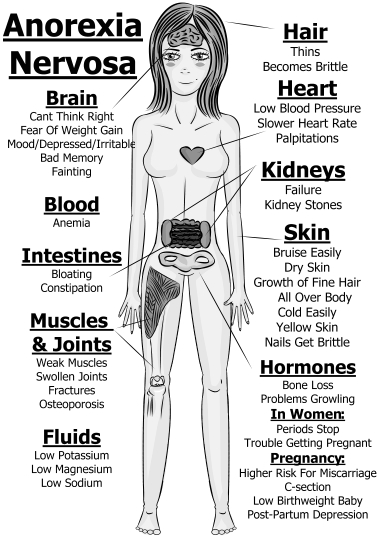 Eating Disorder Types and Symptoms